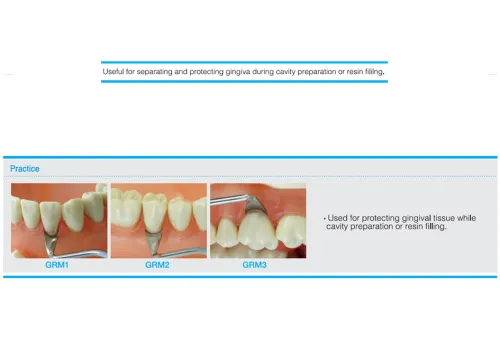 Gingival Retractor - Margin Trimer - Placement Gingival Retractors 3 gingival_retractor_practice