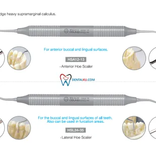 Scaler Hoe Scalers 2 isinya_hoe_scaler_part_1