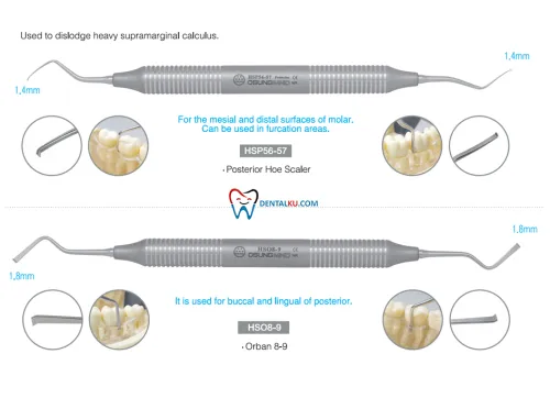 Scaler Hoe Scalers 3 isinya_hoe_scaler_part_2