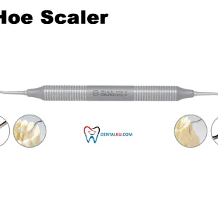 Scaler Hoe Scalers 1 tmb_hoe_scaler