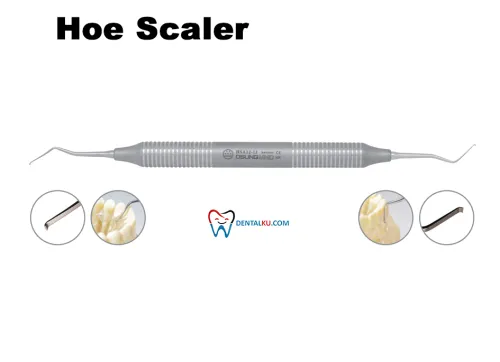 Scaler Hoe Scalers 1 tmb_hoe_scaler