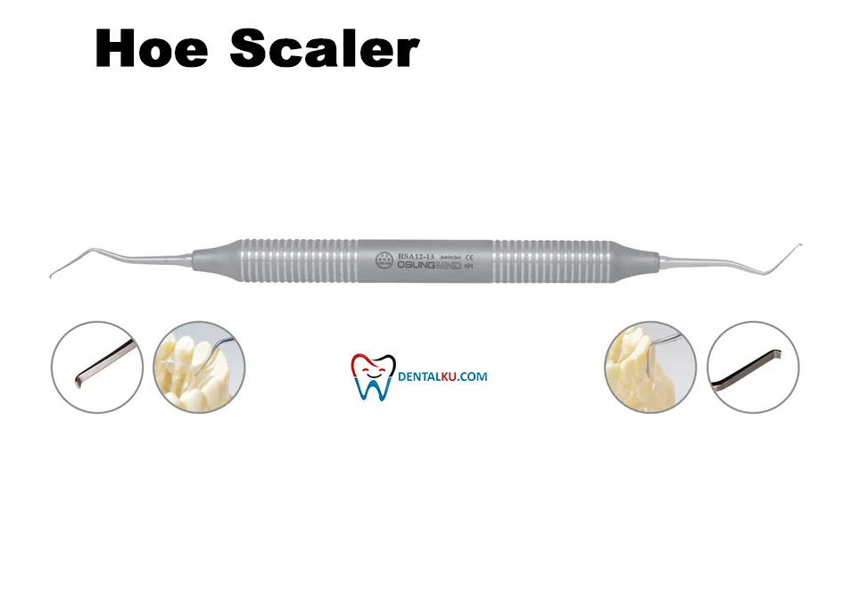 Hoe Scalers Scaler