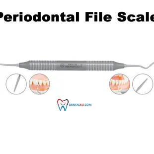 Scaler Periodontal File Scaler 1 tmb_perio_file_scaler